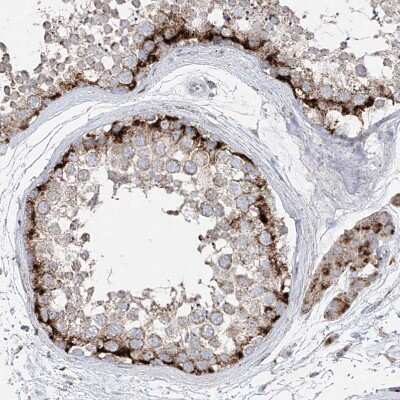 Immunohistochemistry-Paraffin: PMP70 Antibody [NBP1-87258]