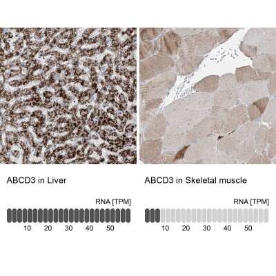 Immunohistochemistry-Paraffin: PMP70 Antibody [NBP1-87258]