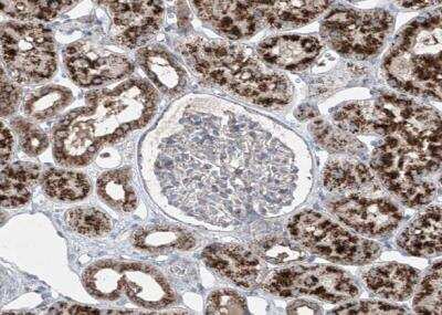 Immunohistochemistry-Paraffin: PMP70 Antibody [NBP1-87258]