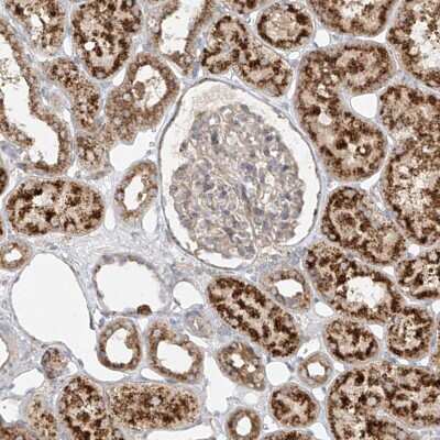 Immunohistochemistry-Paraffin: PMP70 Antibody [NBP2-38199]