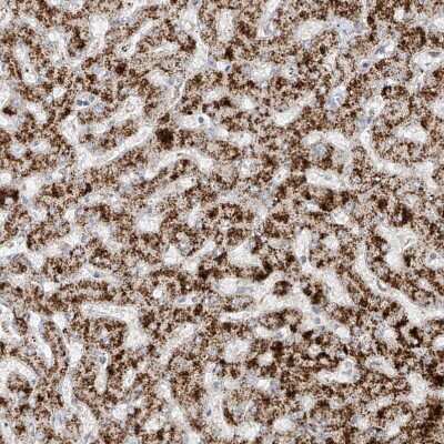 Immunohistochemistry-Paraffin: PMP70 Antibody [NBP2-38199]