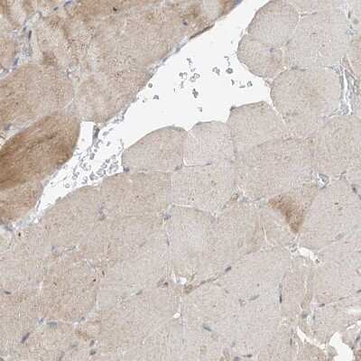 Immunohistochemistry-Paraffin: PMP70 Antibody [NBP2-38199]