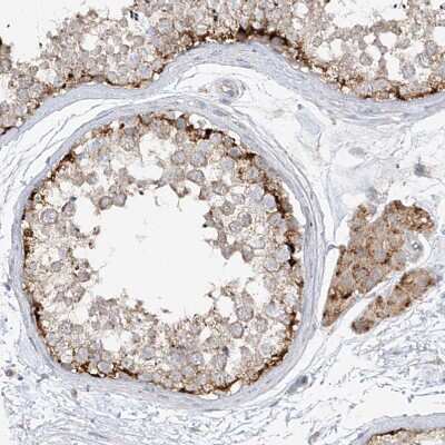 Immunohistochemistry-Paraffin: PMP70 Antibody [NBP2-38199]