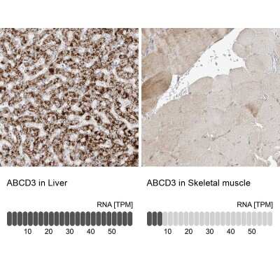 Immunohistochemistry-Paraffin: PMP70 Antibody [NBP2-38199]