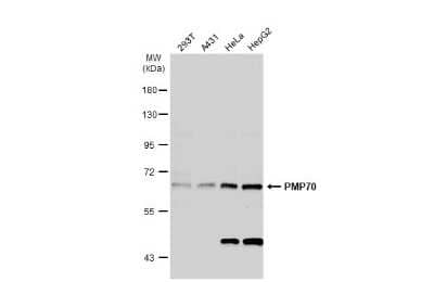 Western Blot: PMP70 Antibody [NBP3-13153]