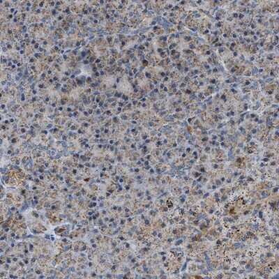 Immunohistochemistry-Paraffin: PMPCA Antibody [NBP1-89126]