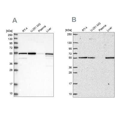 Western Blot: PMPCA Antibody [NBP1-89126]