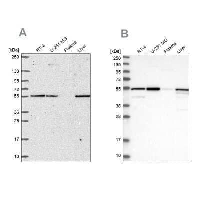 Western Blot: PMPCA Antibody [NBP2-57169]