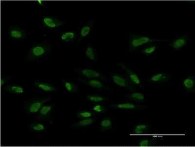 Immunocytochemistry/ Immunofluorescence: PMS2 Antibody (4D11) [H00005395-M05]