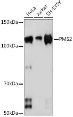 Western Blot: PMS2 Antibody (4E5F1) [NBP3-16441]