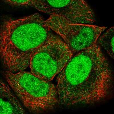 Immunocytochemistry/ Immunofluorescence: PMS2 Antibody [NBP2-56323]