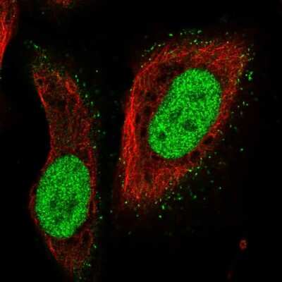 Immunocytochemistry/ Immunofluorescence: PMS2 Antibody [NBP2-56511]