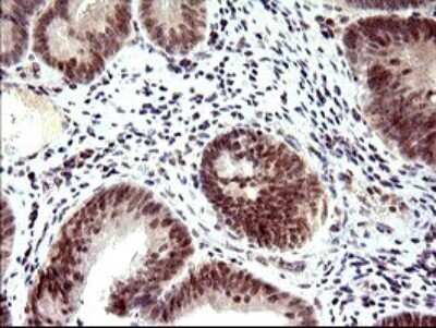 Immunohistochemistry: PMS2 Antibody (OTI2G5) [NBP2-46459]