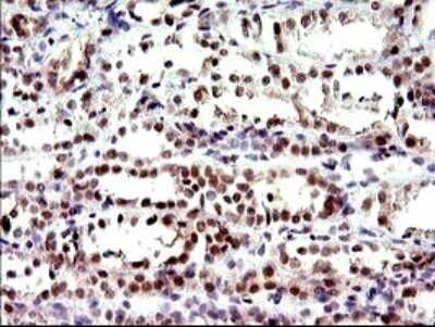 Immunohistochemistry: PMS2 Antibody (OTI2G5) [NBP2-46459]