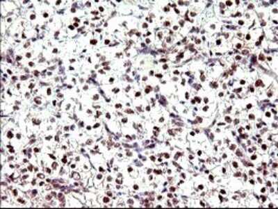 Immunohistochemistry: PMS2 Antibody (OTI2G5) [NBP2-46459]