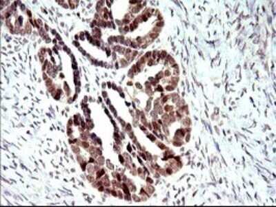 Immunohistochemistry: PMS2 Antibody (OTI2G5) [NBP2-46459]