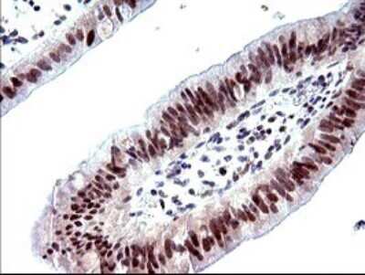 Immunohistochemistry: PMS2 Antibody (OTI2G5) [NBP2-46459]