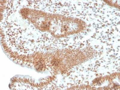 Immunohistochemistry-Paraffin: PMS2 Antibody (PMS2/4373R) [NBP3-07615]