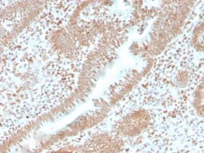 Immunohistochemistry-Paraffin: PMS2 Antibody (PMS2/4373R) - Azide and BSA Free [NBP3-08570]