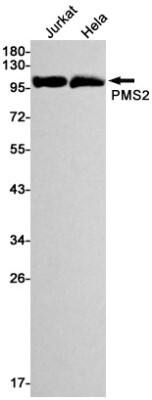 Western Blot: PMS2 Antibody (S06-5G3) [NBP3-19531]