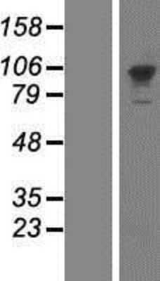 Western Blot: PMS2 Overexpression Lysate [NBP2-09012]