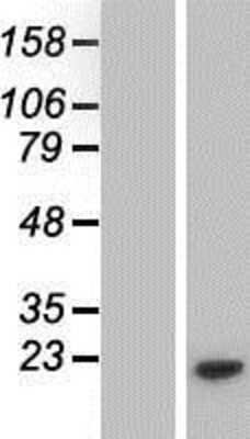 Western Blot: PMS5 Overexpression Lysate [NBP2-10469]