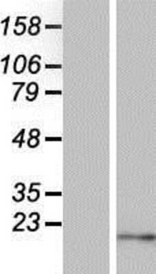 Western Blot: PMS7 Overexpression Lysate [NBP2-05102]