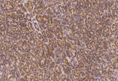 Immunohistochemistry-Paraffin: PMVK/phosphomevalonate kinase Antibody (003) [NBP2-90296]