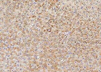 Immunohistochemistry-Paraffin: PMVK/phosphomevalonate kinase Antibody (003) [NBP2-90296]