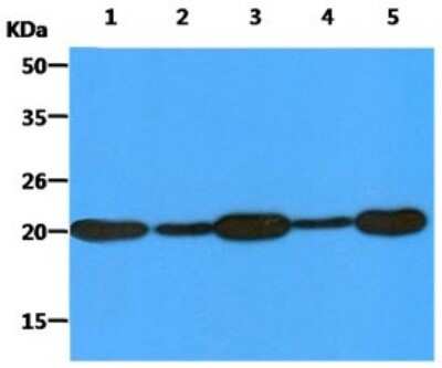 Western Blot: PMVK/phosphomevalonate kinase Antibody (21C10)BSA Free [NBP2-59412]