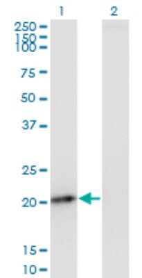 Western Blot: PMVK/phosphomevalonate kinase Antibody (2B8) [H00010654-M07]