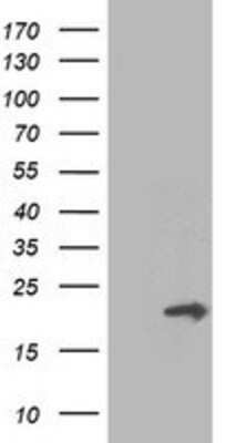 Western Blot: PMVK/phosphomevalonate kinase Antibody (OTI2F9) [NBP2-01157]