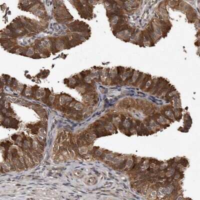 Immunohistochemistry: PMVK/phosphomevalonate kinase Antibody [NBP1-83142]