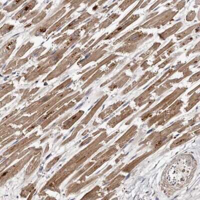 Immunohistochemistry-Paraffin: PMVK/phosphomevalonate kinase Antibody [NBP1-83142]