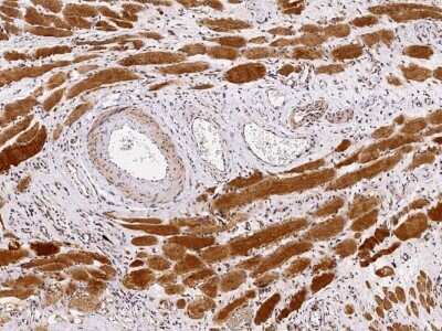 Immunohistochemistry-Paraffin: PMVK/phosphomevalonate kinase Antibody [NBP3-00339]