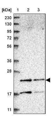 Western Blot: PMVK/phosphomevalonate kinase Antibody [NBP1-83142]