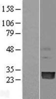 Western Blot: PMVK/phosphomevalonate kinase Overexpression Lysate [NBL1-14541]