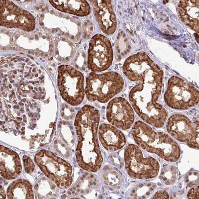 Immunohistochemistry-Paraffin: PNAS-127 Antibody [NBP2-14376]