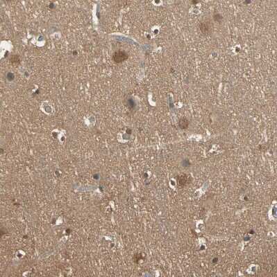 Immunohistochemistry-Paraffin: PNCK Antibody [NBP1-86652]