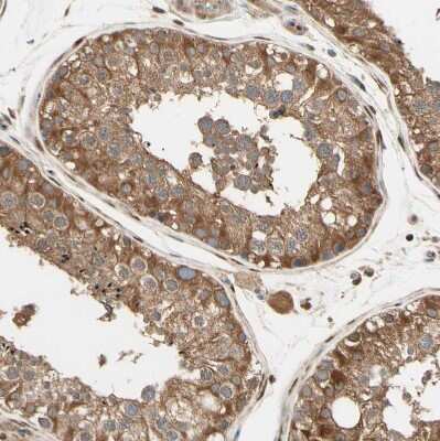 Immunohistochemistry-Paraffin: PNCK Antibody [NBP1-86652]