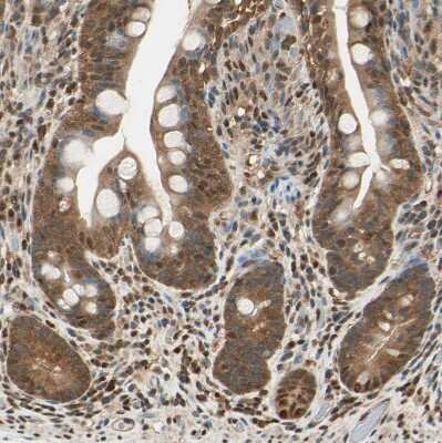 Immunohistochemistry-Paraffin: PNCK Antibody [NBP1-86652]