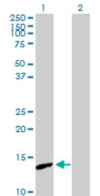 Western Blot: PNCK Antibody [H00139728-B01P]