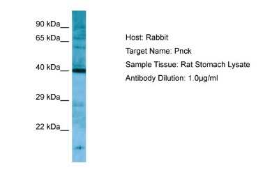 Western Blot: PNCK Antibody [NBP1-98426]