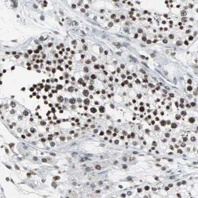 Immunohistochemistry-Paraffin: PNK Antibody [NBP1-87257]