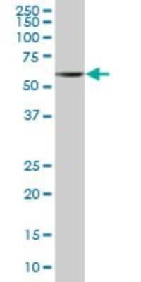 Western Blot: PNK Antibody [H00011284-B01P]