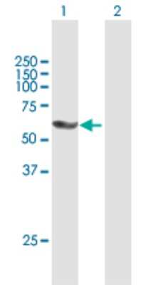 Western Blot: PNK Antibody [H00011284-B01P]