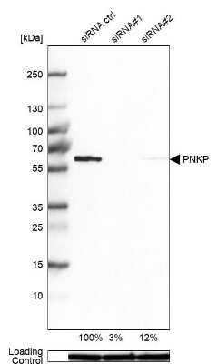 Western Blot: PNK Antibody [NBP1-87257]