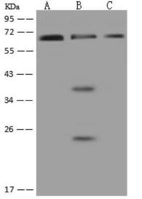 Western Blot: PNK Antibody [NBP3-12588]