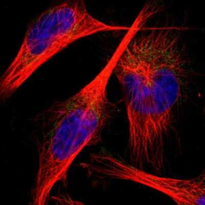 Immunocytochemistry/ Immunofluorescence: PNKD Antibody [NBP1-88348]