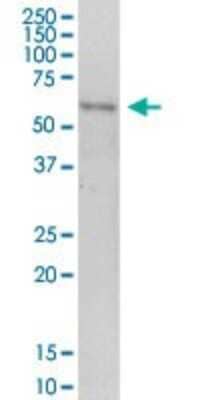 Western Blot: PNKD Antibody [H00025953-B01P]